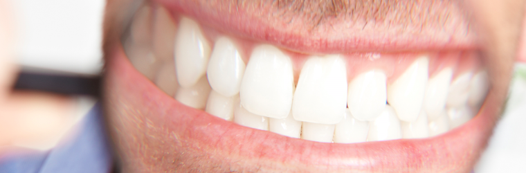 10 cose che non sai sui denti